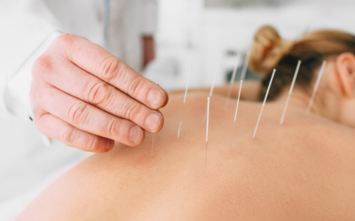 I benefici dell’agopuntura per il trattamento del dolore