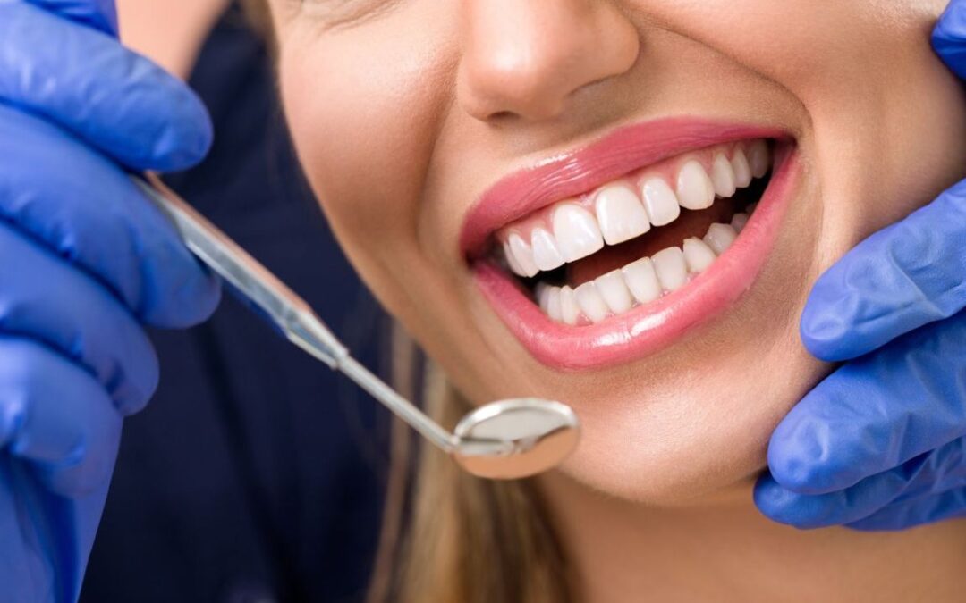 prevenire malocclusioni dentali