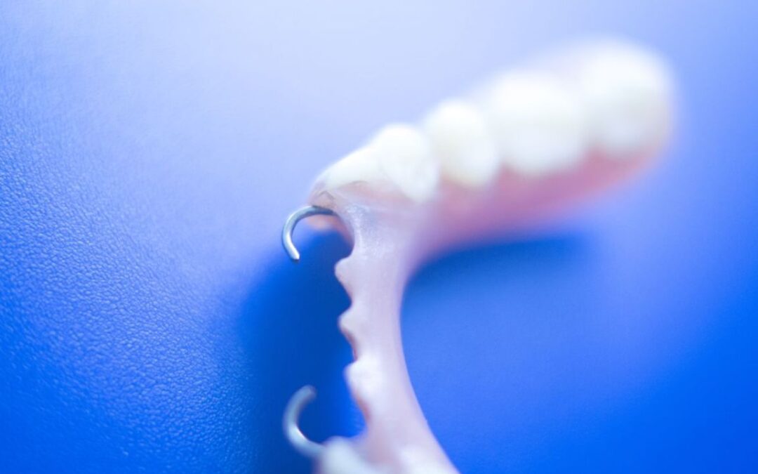 protesi dentarie di ultima generazione