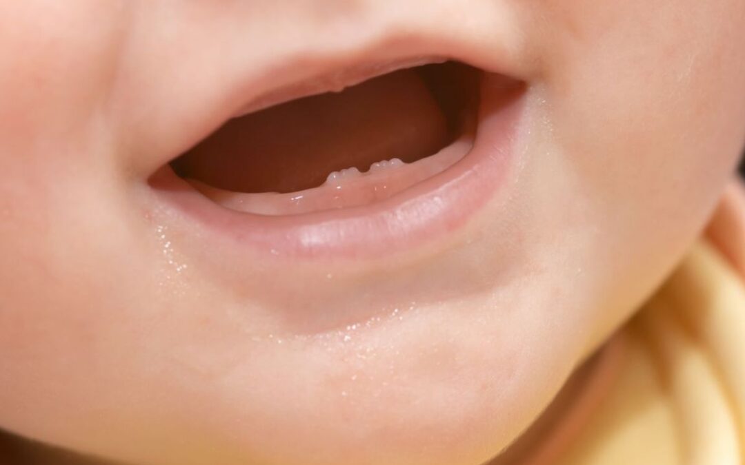 eruzione dentale nel bambino