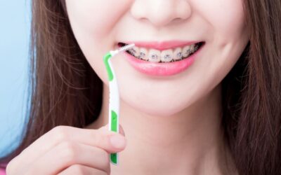 Lavare i denti con l’apparecchio fisso: alcuni consigli