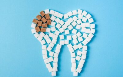 5 cibi che danneggiano lo smalto dentale